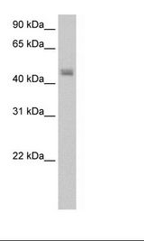 FARS2 Antibody - Transfected 293T Cell Lysate.  This image was taken for the unconjugated form of this product. Other forms have not been tested.