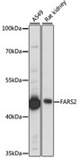 FARS2 Antibody - Western blot analysis of extracts of various cell lines, using FARS2 antibody at 1:1000 dilution. The secondary antibody used was an HRP Goat Anti-Rabbit IgG (H+L) at 1:10000 dilution. Lysates were loaded 25ug per lane and 3% nonfat dry milk in TBST was used for blocking. An ECL Kit was used for detection and the exposure time was 15s.