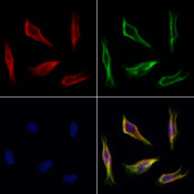 FARS2 Antibody - Staining HeLa cells by IF/ICC. The samples were fixed with PFA and permeabilized in 0.1% Triton X-100, then blocked in 10% serum for 45 min at 25°C. Samples were then incubated with primary Ab(1:200) and mouse anti-beta tubulin Ab(1:200) for 1 hour at 37°C. An AlexaFluor594 conjugated goat anti-rabbit IgG(H+L) Ab(1:200 Red) and an AlexaFluor488 conjugated goat anti-mouse IgG(H+L) Ab(1:600 Green) were used as the secondary antibod