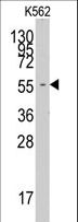 FARSA Antibody - Western blot of anti-FARSA antibody in K562 cell line lysates (35 ug/lane). FARSA (arrow) was detected using the purified antibody.