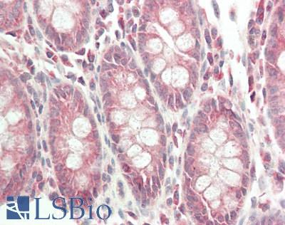 FARSA Antibody - Human Colon: Formalin-Fixed, Paraffin-Embedded (FFPE).  This image was taken for the unconjugated form of this product. Other forms have not been tested.