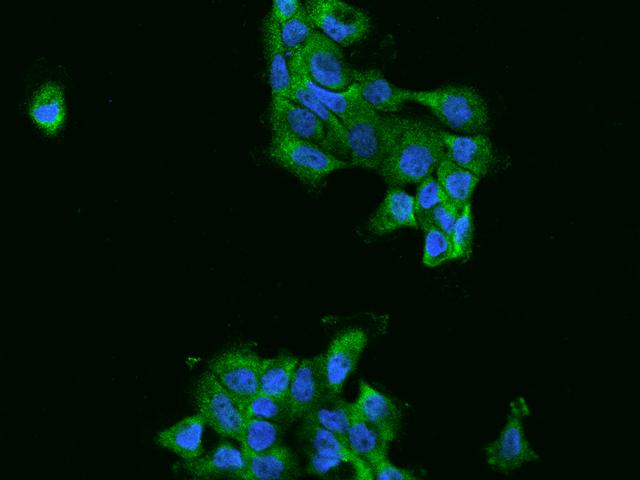 FARSA Antibody - Immunofluorescence staining of FARSA in A431 cells. Cells were fixed with 4% PFA, permeabilzed with 0.1% Triton X-100 in PBS, blocked with 10% serum, and incubated with rabbit anti-Human FARSA polyclonal antibody (dilution ratio 1:200) at 4°C overnight. Then cells were stained with the Alexa Fluor 488-conjugated Goat Anti-rabbit IgG secondary antibody (green) and counterstained with DAPI (blue). Positive staining was localized to Cytoplasm.