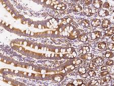 FARSA Antibody - Immunochemical staining of human FARSA in human duodenum with rabbit polyclonal antibody at 1:500 dilution, formalin-fixed paraffin embedded sections.