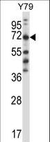 FARSB Antibody - FARSB Antibody western blot of Y79 cell line lysates (35 ug/lane). The FARSB antibody detected the FARSB protein (arrow).