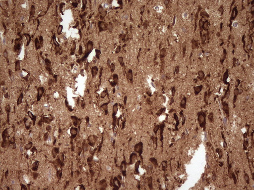 FARSB Antibody - Immunohistochemical staining of paraffin-embedded Human adult brain tissue using anti-FARSB mouse monoclonal antibody. (Heat-induced epitope retrieval by 1 mM EDTA in 10mM Tris, pH8.5, 120C for 3min,