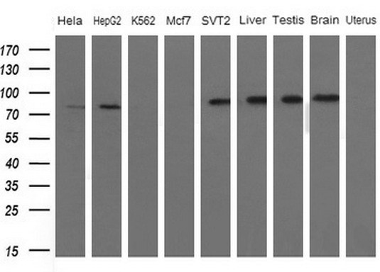 FARSB Antibody - Western blot analysis of extracts. (10ug) from 5 different cell lines and 4 human tissue by using anti-FARSB monoclonal antibody. (1: Hela; 2: HepG2; 3: K562; 4: Mcf7; 5: SVT2; 6: Liver; 7: Testis; 8: Brain; 9: Uterus) at 1:200 dilution.