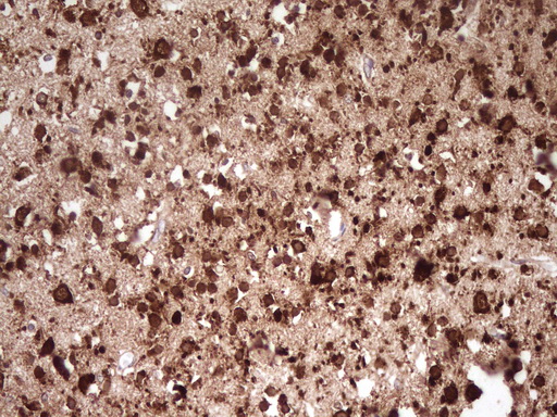 FARSB Antibody - Immunohistochemical staining of paraffin-embedded Human embryonic brain cortex tissue using anti-FARSB mouse monoclonal antibody. (Heat-induced epitope retrieval by 1 mM EDTA in 10mM Tris, pH8.5, 120C for 3min,