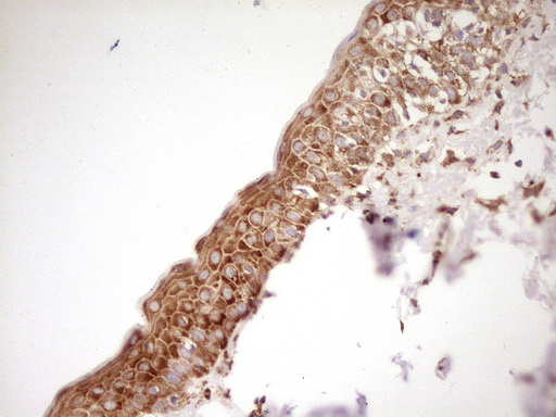 FARSB Antibody - IHC of paraffin-embedded Human skin tissue using anti-FARSB mouse monoclonal antibody. (Heat-induced epitope retrieval by 1 mM EDTA in 10mM Tris, pH8.5, 120°C for 3min).