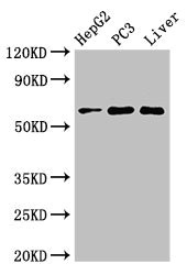 FARSB Antibody - Western Blot Positive WB detected in:HepG2 whole cell lysate,PC3 whole cell lysate,Mouse liver tissue All Lanes:FARSB antibody at 2.7µg/ml Secondary Goat polyclonal to rabbit IgG at 1/50000 dilution Predicted band size: 67,55 KDa Observed band size: 67 KDa