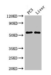 FARSB Antibody - Western Blot Positive WB detected in: PC-3 whole cell lysate, Mouse liver tissue All lanes: FARSB antibody at 2.7µg/ml Secondary Goat polyclonal to rabbit IgG at 1/50000 dilution Predicted band size: 67, 55 kDa Observed band size: 55 kDa