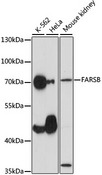 FARSB Antibody - Western blot analysis of extracts of various cell lines, using FARSB antibody at 1:1000 dilution. The secondary antibody used was an HRP Goat Anti-Rabbit IgG (H+L) at 1:10000 dilution. Lysates were loaded 25ug per lane and 3% nonfat dry milk in TBST was used for blocking. An ECL Kit was used for detection and the exposure time was 30s.