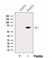 FARSB Antibody - Western blot analysis of extracts of COLO205 cells using FARSB antibody. The lane on the left was treated with blocking peptide.