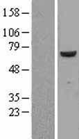 FARSB Protein - Western validation with an anti-DDK antibody * L: Control HEK293 lysate R: Over-expression lysate