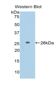 FASLG / Fas Ligand Antibody - Western blot of recombinant FASLG / FASL / Fas Ligand.  This image was taken for the unconjugated form of this product. Other forms have not been tested.