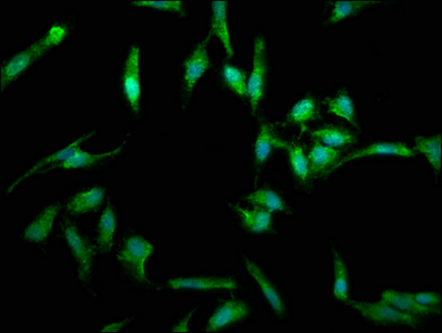 FASLG / Fas Ligand Antibody - Immunofluorescence staining of Hela cells with FASLG Antibody at 1:330, counter-stained with DAPI. The cells were fixed in 4% formaldehyde, permeabilized using 0.2% Triton X-100 and blocked in 10% normal Goat Serum. The cells were then incubated with the antibody overnight at 4°C. The secondary antibody was Alexa Fluor 488-congugated AffiniPure Goat Anti-Rabbit IgG(H+L).