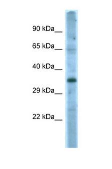 FASLG / Fas Ligand Antibody - FASLG / FASL antibody Western blot of HeLa Cell lysate. Antibody concentration 1 ug/ml.  This image was taken for the unconjugated form of this product. Other forms have not been tested.
