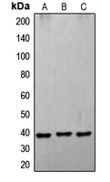 FASLG / Fas Ligand Antibody - Western blot analysis of CD178 expression in A549 (A); K562 (B); HL60 (C) whole cell lysates.