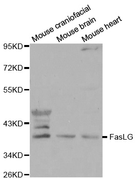 FASLG / Fas Ligand Antibody - Western blot analysis of extracts from various mouse tissues.