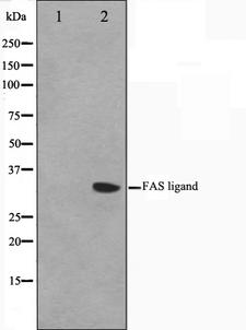 FASLG / Fas Ligand Antibody - Western blot analysis on 293 cell lysates using FASL antibody. The lane on the left is treated with the antigen-specific peptide.