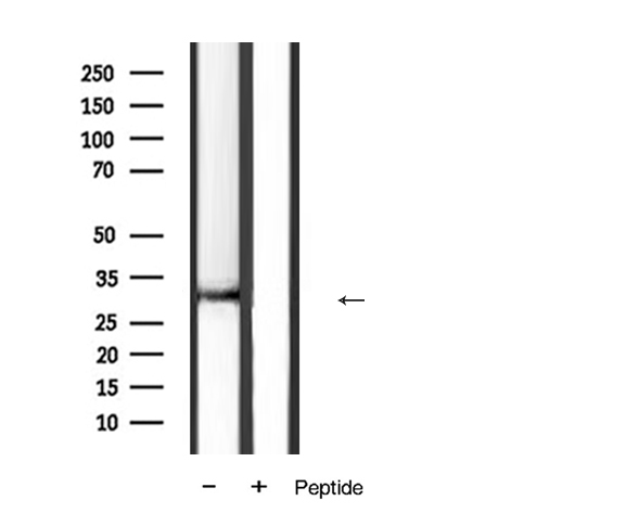 FASLG / Fas Ligand Antibody - Western blot analysis of FAS ligand antibody expression in mouse heart tissue lysates. The lane on the right is treated with the antigen-specific peptide.