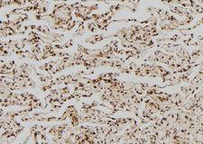 FASLG / Fas Ligand Antibody - 1:100 staining human lung tissue by IHC-P. The sample was formaldehyde fixed and a heat mediated antigen retrieval step in citrate buffer was performed. The sample was then blocked and incubated with the antibody for 1.5 hours at 22°C. An HRP conjugated goat anti-rabbit antibody was used as the secondary.