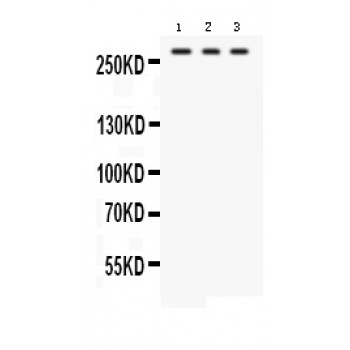 FASN / Fatty Acid Synthase Antibody - Western blot analysis of FASN expression in HEPG2 whole cell lysates (lane 1), U87 whole cell lysates (lane 2) and RAJI whole cell lysates (lane 3). FASN at 273 kD was detected using rabbit anti- FASN Antigen Affinity purified polyclonal antibody at 0.5 ug/mL. The blot was developed using chemiluminescence (ECL) method.