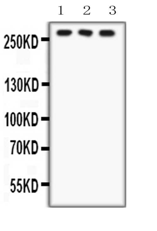 FASN / Fatty Acid Synthase Antibody - Western blot analysis of FASN expression in HEPG2 whole cell lysates (lane 1), U87 whole cell lysates (lane 2) and RAJI whole cell lysates (lane 3). FASN at 273KD was detected using rabbit anti-FASN Antigen Affinity purified polyclonal antibody at0.5 ug/ml. The blot was developed using chemiluminescence (ECL) method.