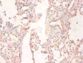 FASN / Fatty Acid Synthase Antibody - Immunohistochemistry of paraffin-embedded human lung tissue using antibody at dilution 1:50.  This image was taken for the unconjugated form of this product. Other forms have not been tested.