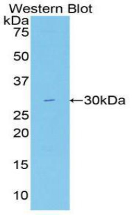 FASN / Fatty Acid Synthase Antibody - Western blot of recombinant FASN / Fatty Acid Synthase.  This image was taken for the unconjugated form of this product. Other forms have not been tested.