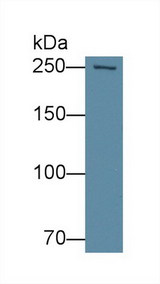 FASN / Fatty Acid Synthase Antibody - Western Blot; Sample: Human Hela