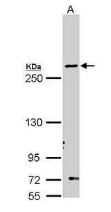 FASN / Fatty Acid Synthase Antibody - Sample (30 ug of whole cell lysate). A: Molt-4 . 5% SDS PAGE. FASN / Fatty Acid Synthase antibody diluted at 1:1000