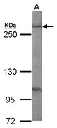 FASN / Fatty Acid Synthase Antibody - Sample (50 ug of whole cell lysate). A: mouse liver. 5% SDS PAGE. FASN / Fatty Acid Synthase antibody diluted at 1:1000.