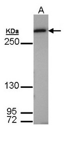 FASN / Fatty Acid Synthase Antibody - Sample (30 ug of whole cell lysate). A: Molt-4 . 7.5% SDS PAGE. FASN / Fatty Acid Synthase antibody diluted at 1:1000
