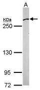 FASN / Fatty Acid Synthase Antibody - Sample (50 ug of whole cell lysate). A: Mouse brain. 5% SDS PAGE. FASN / Fatty Acid Synthase antibody diluted at 1:1000.