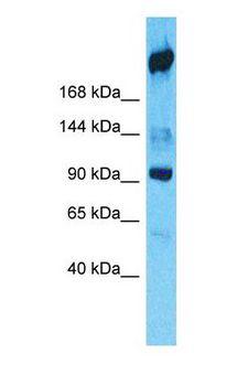 FASN / Fatty Acid Synthase Antibody - Western blot of FASN Antibody with 293T Whole cell lysate.  This image was taken for the unconjugated form of this product. Other forms have not been tested.