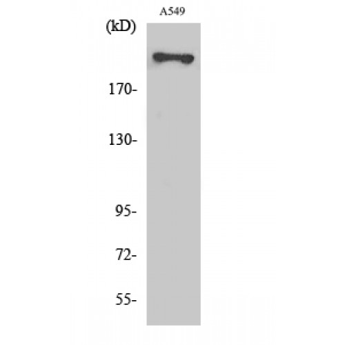 FASN / Fatty Acid Synthase Antibody - Western blot of Fatty Acid Synthase antibody