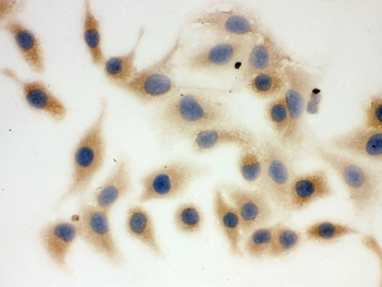 FASN / Fatty Acid Synthase Antibody - ICC testing of FFPE human A549 cells with FASN antibody. HIER: Boil the paraffin sections in pH 6, 10mM citrate buffer for 20 minutes and allow to cool prior to staining.
