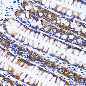FASN / Fatty Acid Synthase Antibody - Immunohistochemistry of paraffin-embedded human colon using FASN antibody at dilution of 1:100 (40x lens).