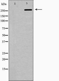 FASN / Fatty Acid Synthase Antibody - Western blot analysis of A549 whole cells lysates using FASN antibody. The lane on the left is treated with the antigen-specific peptide.