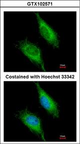 FASTK / FAST Antibody - Immunofluorescence of methanol-fixed HeLa using FAST antibody at 1:200 dilution.