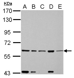 FASTK / FAST Antibody - FAST antibody detects FASTK protein by Western blot analysis. A. 30 ug 293T whole cell lysate/extract. B. 30 ug A431 whole cell lysate/extract. C. 30 ug HeLa whole cell lysate/extract. D. 30 ug HepG2 whole cell lysate/extract. E. 30 ug A375 whole cell lysate/extract. 7.5 % SDS-PAGE. FAST antibody dilution:1:1000