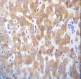 FASTK / FAST Antibody - FASTK Antibody immunohistochemistry of formalin-fixed and paraffin-embedded human liver tissue followed by peroxidase-conjugated secondary antibody and DAB staining.