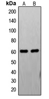 FASTK / FAST Antibody - Western blot analysis of FAST Kinase expression in PC12 (A); HL60 (B) whole cell lysates.