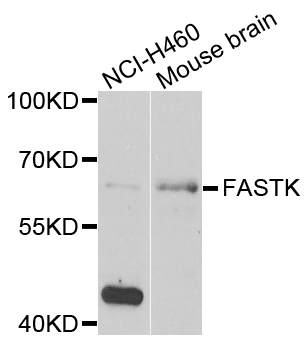 FASTK / FAST Antibody - Western blot analysis of extracts of various cells.