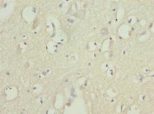 FASTK / FAST Antibody - Immunohistochemistry of paraffin-embedded human brain tissue at dilution 1:100
