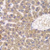 FASTK / FAST Antibody - Immunohistochemistry of paraffin-embedded Rat liver using FASTK Polyclonal Antibody at dilution of 1:100 (40x lens).