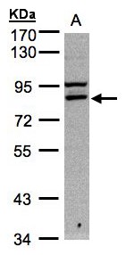 FASTKD1 Antibody - Sample. A:30g of Hep G2 whole cell lysate . 7.5% SDS PAGE. FASTKD1 antibody diluted at 1:1000