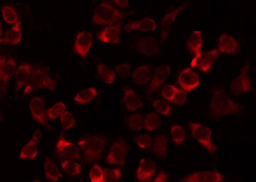 FASTKD1 Antibody - Staining HeLa cells by IF/ICC. The samples were fixed with PFA and permeabilized in 0.1% Triton X-100, then blocked in 10% serum for 45 min at 25°C. The primary antibody was diluted at 1:200 and incubated with the sample for 1 hour at 37°C. An Alexa Fluor 594 conjugated goat anti-rabbit IgG (H+L) Ab, diluted at 1/600, was used as the secondary antibody.