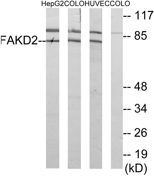 FASTKD2 Antibody - Western blot analysis of lysates from HUVEC, HepG2, and COLO cells, using FAKD2 Antibody. The lane on the right is blocked with the synthesized peptide.