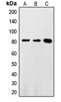 FASTKD2 Antibody - Western blot analysis of FASTKD2 expression in HeLa (A); Jurkat (B); Ramos (C) whole cell lysates.